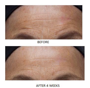 Dr. Denese SkinScience Advanced Firming Facial Pads 100 Count – Professional Exfoliator with Glycolic Acid, Peptides and Aloe for Smooth Radiant Skin, Refined Pores – Dermatologist Tested Cruelty Free