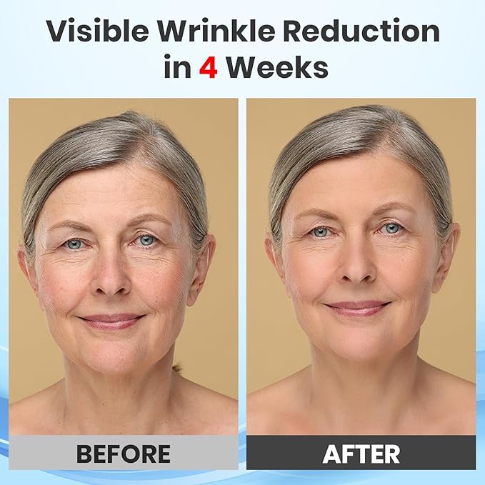 Light Therapy System(Model:L6) - 4 Modes Face Mask Light Therapy,Red Light Therapy for Face Desigh Skin Care at Home&Travel,Women & Men Gift Idea