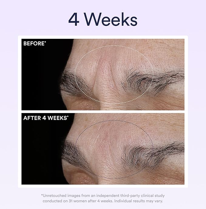 OSEA Dream Night Serum with Bio-Retinol - 1oz - Anti-Aging Night Serum for Face - Firming Peptides - Reduces Wrinkles, Firms & Brightens Skin (Pack of 2)