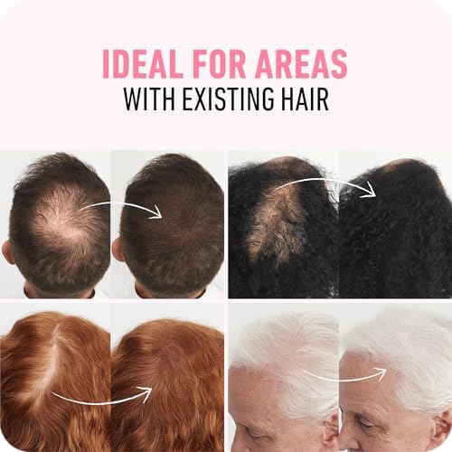 BOLDIFY Hair Fibers (56.5g) Fill In Fine and Thinning Hair for an Instantly Thicker & Fuller Look - Best Value & Superior Formula -14 Shades for Women & Men - Dark Blonde