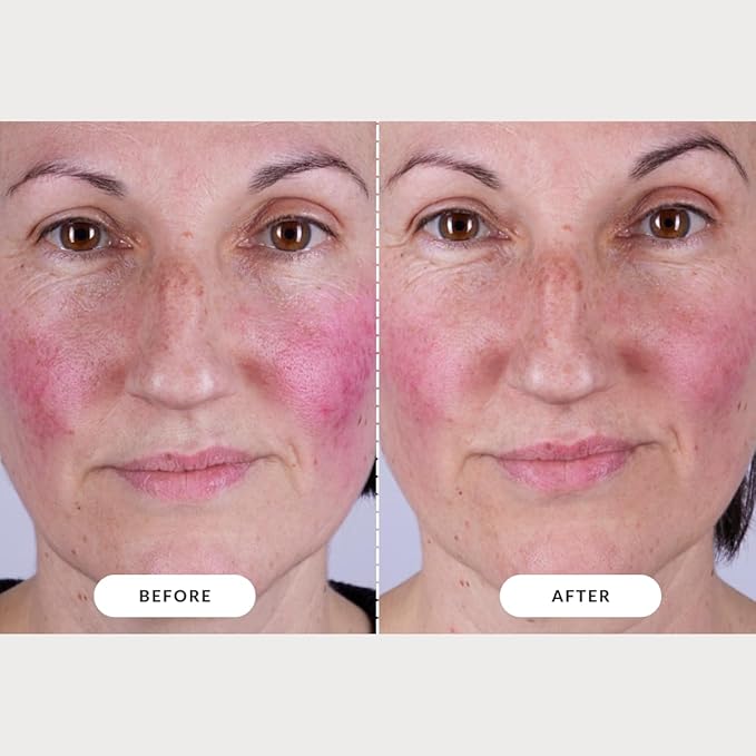 CurrentBody Skin LED Light Therapy Mask: Series 2