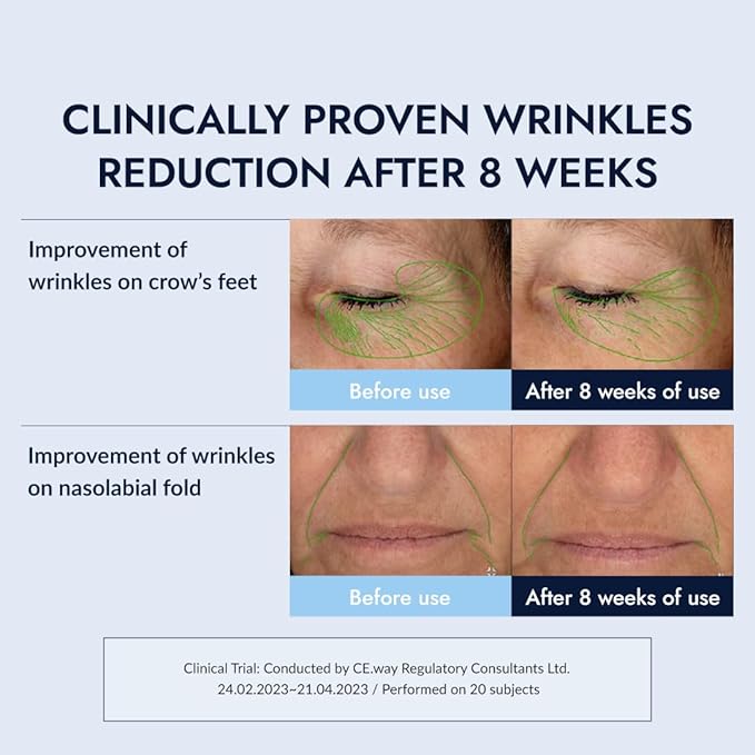 MIZON Retinol Youth (0.1% Retinol Serum) Fine Line Treatment Bakuchiol Peptides Niacinamide Youthful Skin Korean Skincare (0.1 oz)