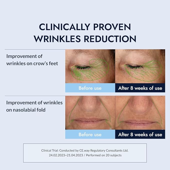 MIZON Retinol Youth 0.3% Retinol Cream with Shea Butter, Peptides, Niacinamide, Bakuchiol Korean Skincare for Fine Line Care (0.92 oz)