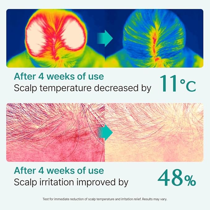 lilyeve SCALPTURN Cica PDRN Scalp Serum with Built-in Brush, PDRN to Strengthen Hair Roots, Itchy Scalp Relief, Dry Scalp Hydration - Korean Hair Care, 3.38 fl.oz