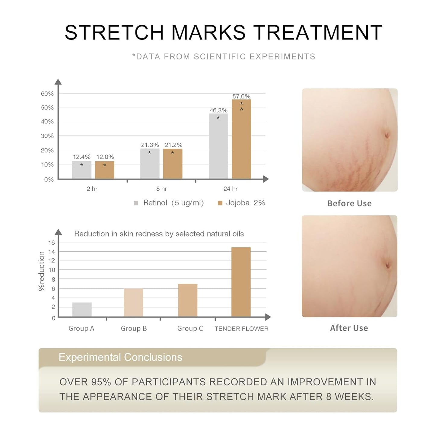 Stretch Mark Oil（110ml）, body oil for Pregnancy,belly oil, belly abdominal Serum Skin Care,Moisturizing Dry Skin, Tender & Softening，True Belly Serum 3.7OZ