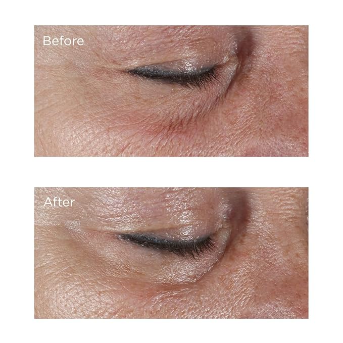 Perricone MD Hypoallergenic Firming Eye Cream, New - 0.5 oz