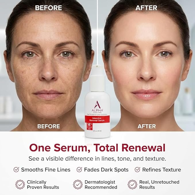 Alpha Skin Care Renewal Serum, 14% Glycolic AHA, Anti-Aging Formula, Reduces Lines & Wrinkles, Alpha Hydroxy Acid Exfoliates & Evens Skin Tones, Rejuvenates & Hydrates, 2 Oz