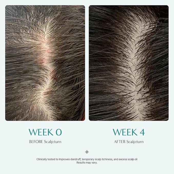 lilyeve SCALPTURN Cica PDRN Scalp Serum with Built-in Brush, PDRN to Strengthen Hair Roots, Itchy Scalp Relief, Dry Scalp Hydration - Korean Hair Care, 3.38 fl.oz