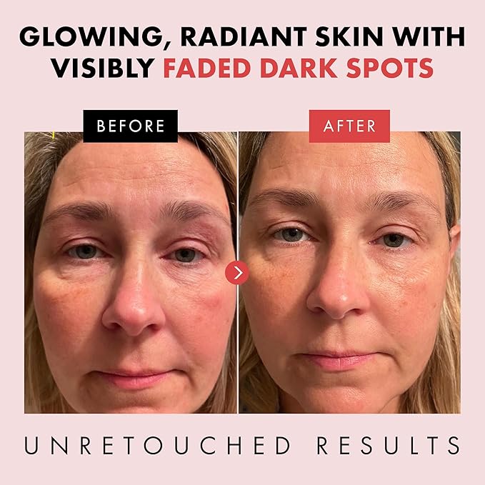 Eclat Skincare Renewing Retinol Serum for Face - Anti Aging Serum with Hyaluronic Acid & Aloe Vera – Hydrates and Improves the Signs of Aging (Fine Lines, Wrinkles & Dark Spots) 1 Fl Oz