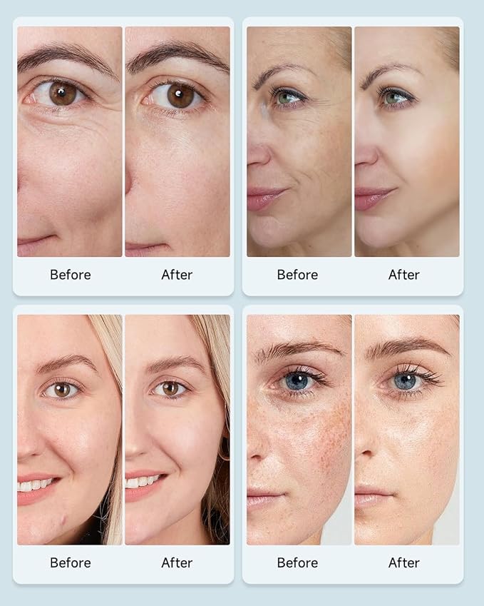 Beauty Led Mask, Led Face Mask Light Therapy