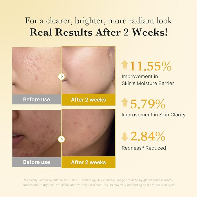 medicube Kojic Acid Renew & Smooth Duo for Troubled Skin: Kojic Acid Turmeric Clarifying Toner Pad and Kojic Acid Turmeric Clarifying & Balancing Capsule Serum, Valentines Day Gifts for Her