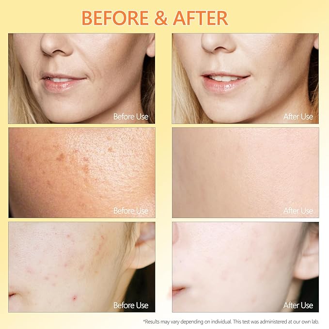 Pure 4% Niacinamide Serum for Acne Treatment for Face & Dark Spots | Brightening Face Serum with 1.5% Vitamin C | 1% Hyaluronic Acid | 1% Ceramide T5 | Made in China (4 fl.oz/120ml) Travel Pack Size