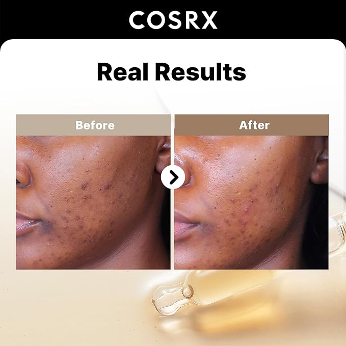 COSRX 6X Peptide Collagen Booster Toner Serum + 2% Alpha Arbutin Discoloration Care Serum