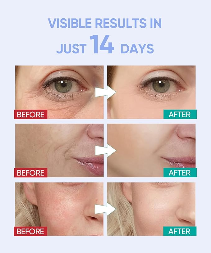 7 Mode Red Light Therapy Mask for Face, FDA-Cleared Portable LED Face Mask with Remote for Wrinkles, Acne & Skin Tone at Home, Near-Infrared 850nm Red Light Therapy Mask, Black