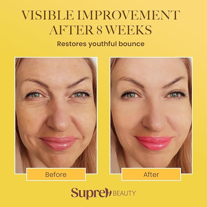 SupreH Bee Venom Cream Wrinkle Filler: Instant Face Lift Cream and Eye Tightener Cream with Hyaluronic acid Niacinamide for women and men 50