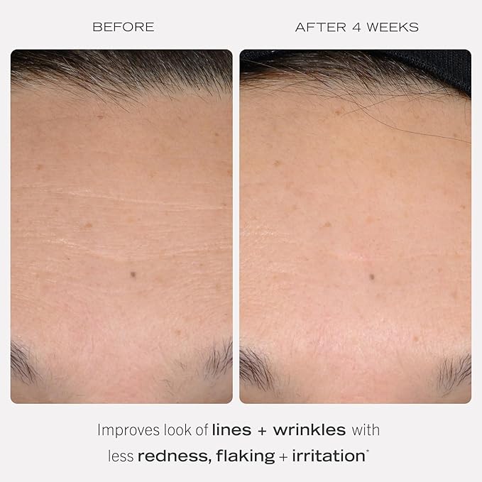 First Aid Beauty - 0.3% Retinol Complex Serum with Peptides, Designed for Sensitive Skin, Helps Visibly Improve Lines and Wrinkles with Less Irritation than Traditional Retinol, Non-Comedogenic, 1 oz