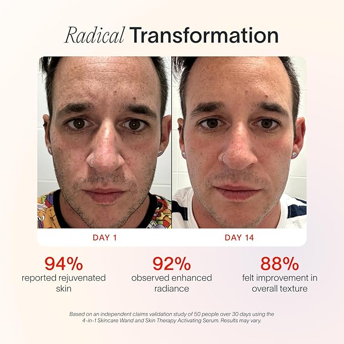 Solawave 4-in-1 Radiant Renewal Facial Wand | Red Light Therapy for Face and Neck | Galvanic Skincare Wand & Facial Massager | Anti-Aging Wrinkle Reduction | Solawave Original | Matte Black