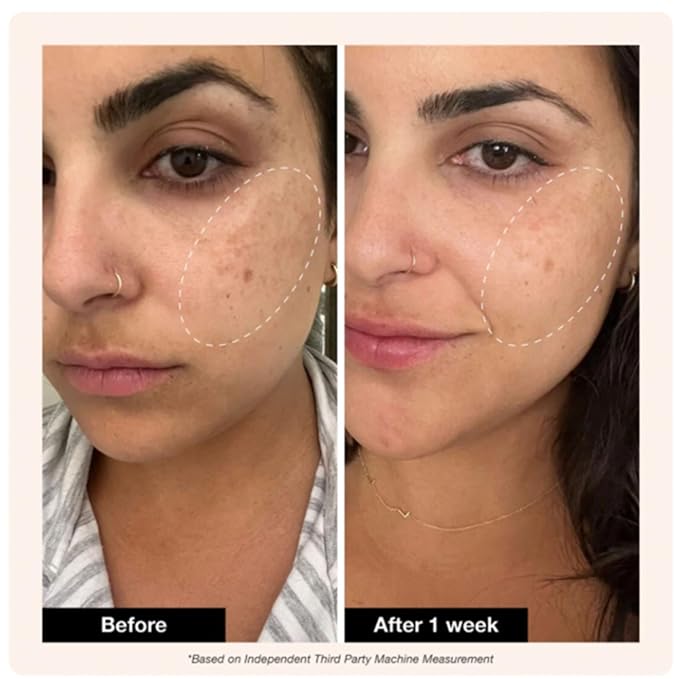 Innbeauty Project Retinol Remix 1% Retinol Treatment with Peptides & Tranexamic Acid for Wrinkles & Texture, 1 OZ (30ml)