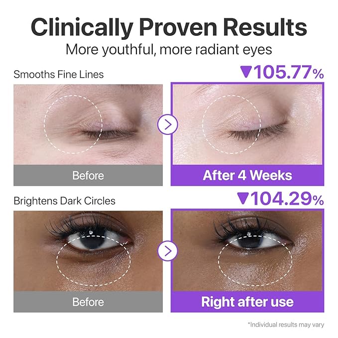 numbuzin No.9 NAD+ Lifting & Wrinkle Care Set | NAD+ BIO Lifting-sil Essence + Retinol Volumetox Eye Cream | Firming, Reduce Wrinkles, Fine Lines | Peptides | Serum for Sagging, Aging, Dull Skin