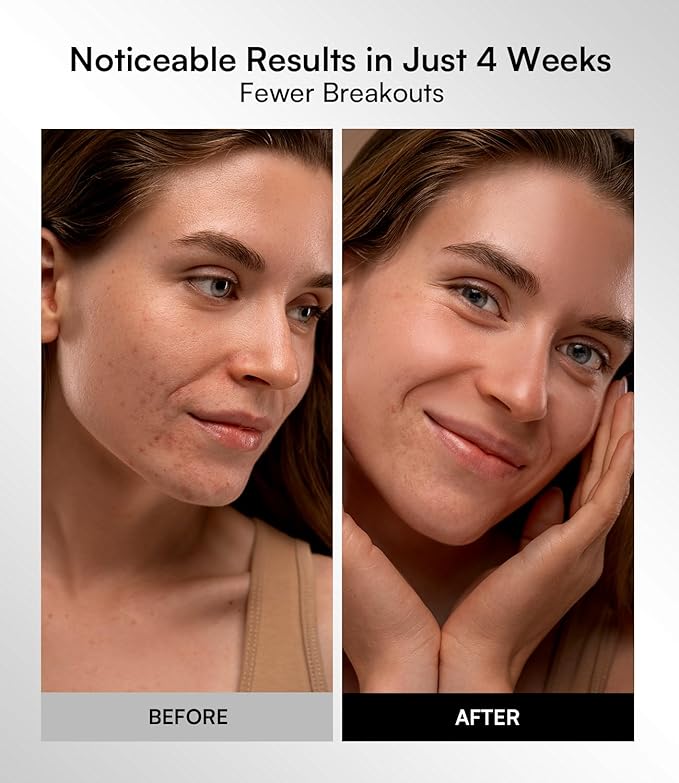 INIA Red Light Therapy Mask for Face – 4 Light Modes with 850nm NIR, Red & Blue LED Light Therapy, 2600mAh Rechargeable LED Face Mask for Radiant Glow at Home, Pink