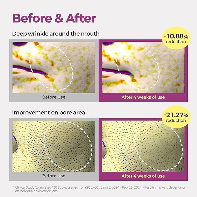 MOTHER MADE Retinol Bakuchiol Night Cream, 1 Fl Oz, Korean Retinal Face Cream to Firm Skin, Reduce Wrinkles, Fine Lines, Signs of Aging, Antiaging, Smoothing, Korean Skincare