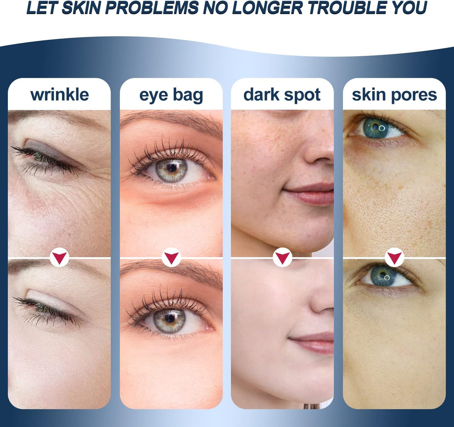 MiSMON High Frequency Facial Machines, 4 in 1 Facial Massager Micro-Current Light Therapy Device for Face