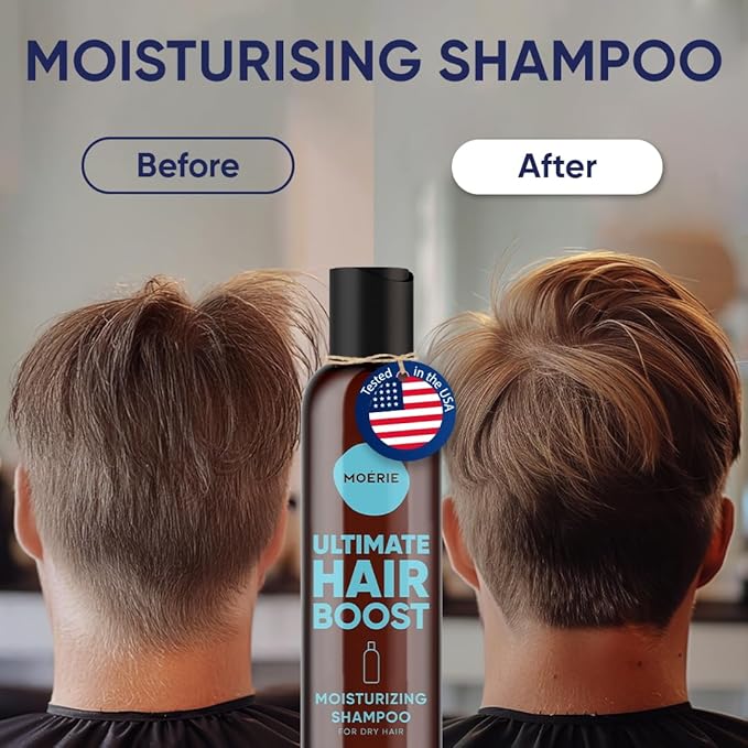 Moerie Ultimate Hair Growth Shampoo – For Longer, Thicker, Fuller Hair - Vegan Friendly Volumizing Hair Products – Paraben & Silicone Free – All Hair Types – Reverse Hair Loss