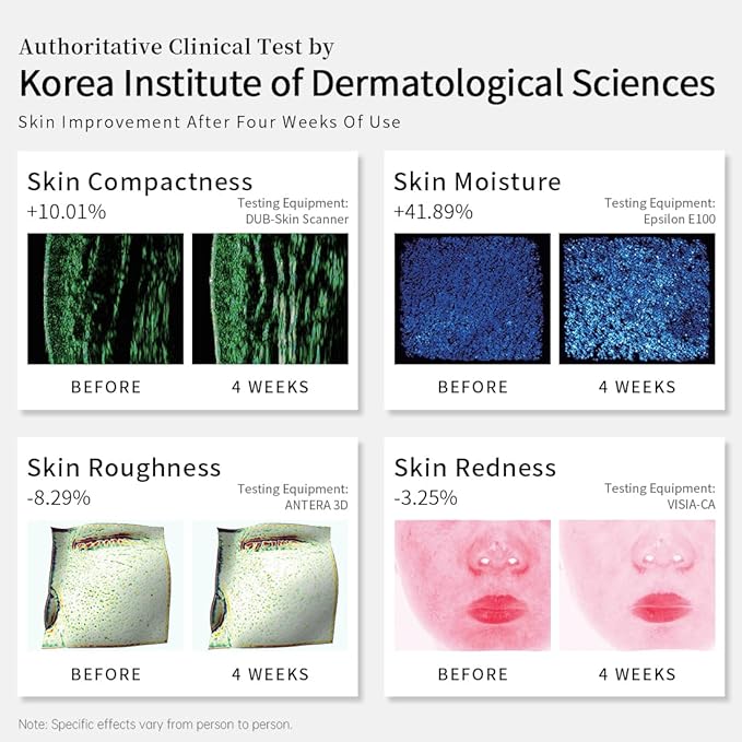 Led Face Mask, Red Light Mask for Face, Infrared, Red & Blue Light Mask for Skin Care, Wrinkle Reduction, Wireless Face Mask. (Miracle MAX RB-030)