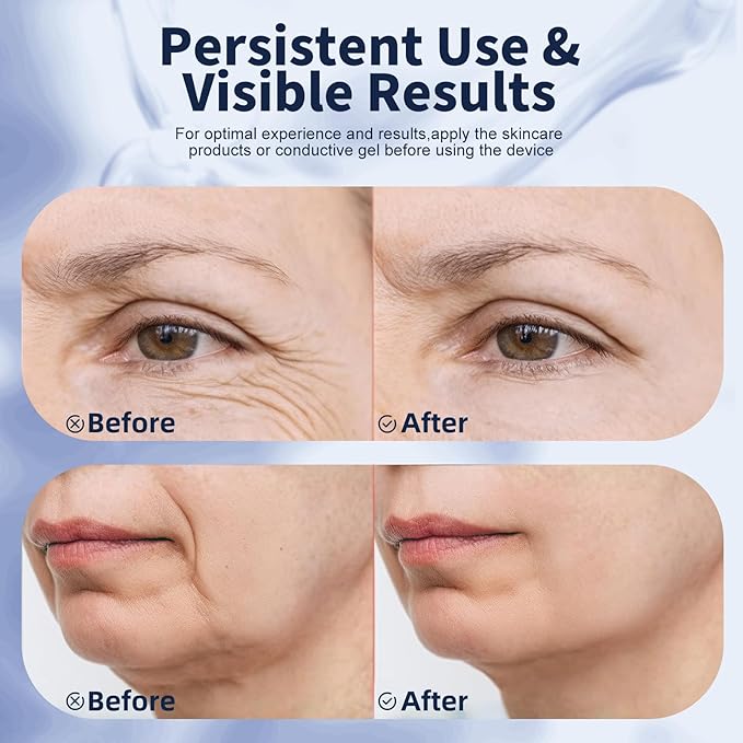 Red Light Therapy for Face, Multifunctional Face Massager with Micro-Current, LED Light Therapy & Vibration, at-Home Skin Care Face Sculpting Tool for Wrinkles, Micro-Current Facial Beauty Device