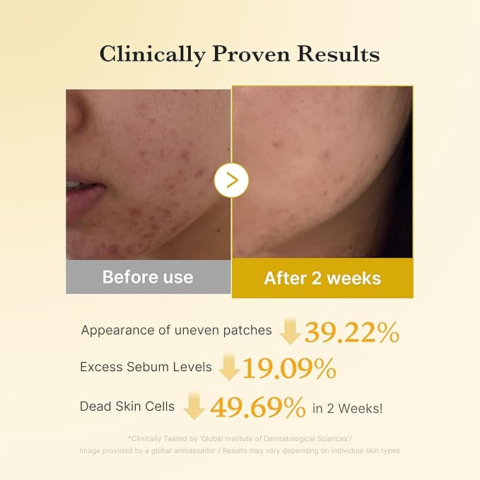 medicube Kojic Acid Prep and Seal Duo for Troubled Skin: Kojic Acid Turmeric Overnight Wrapping Peel Off Mask 2.0 and Kojic Acid Turmeric Clarifying Toner Pad