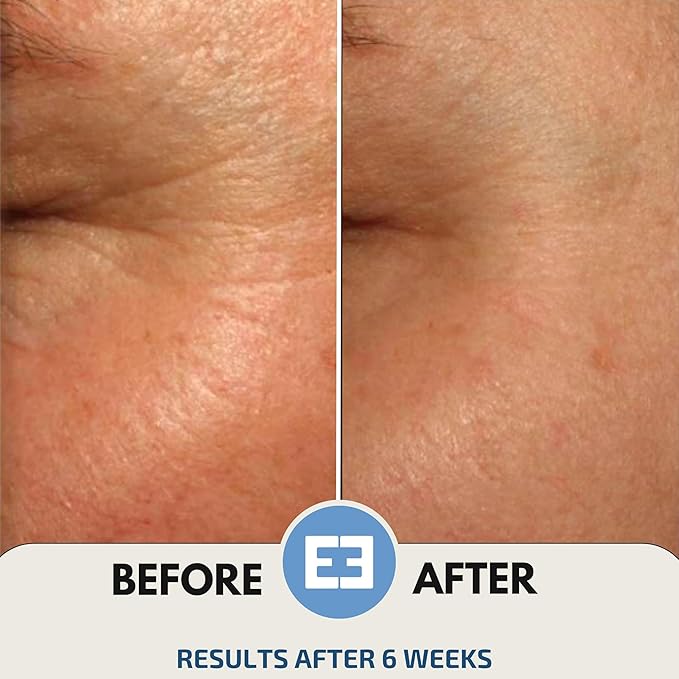 EiE 01 Klotho Peptides Serum for Face Hydrating Peptide Face Serum for Women Anti Aging Improves Wrinkles Elasticity Facial Peptide Serums with Hyaluronic Acid and Retinol Made in Sweden 1 fl. Oz