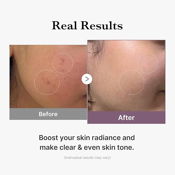 medicube All Over Glow Skin Duo: Deep Vitamin C Golden Capsule Face Moisturizer and Age-R Glutathione Glow Milky Toner