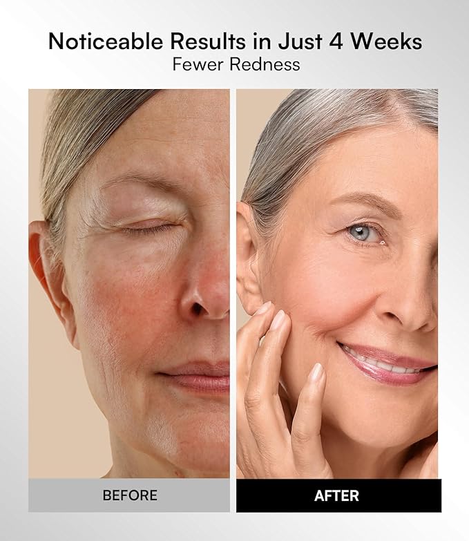 INIA Red Light Therapy Mask for Face – 4 Light Modes with 850nm NIR, Red & Blue LED Light Therapy, 2600mAh Rechargeable LED Face Mask for Radiant Glow at Home, Pink