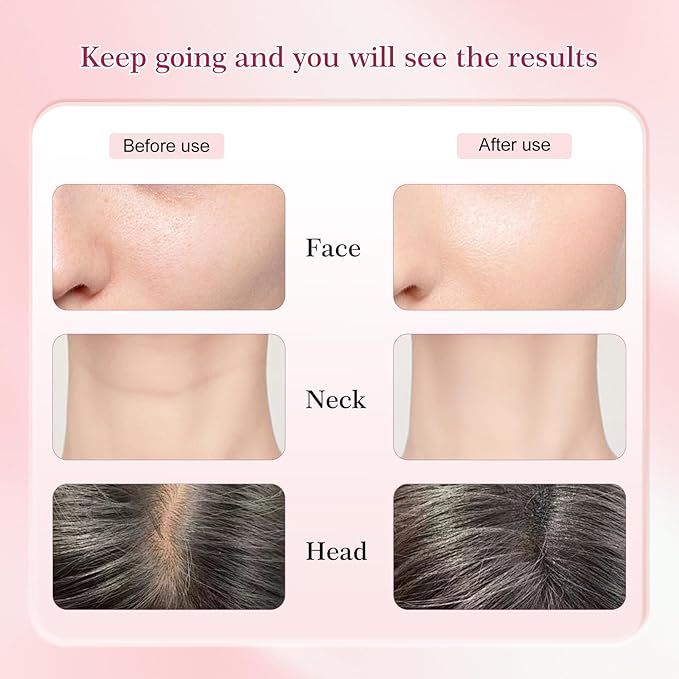 Red-Light-Therapy-for-Face and Neck-Eye-Head Massager,7 Colors Skin Rejuvenation Lifting Facial Massager for Toning,Glow Boost，Wrinkle for Birthday,Christmas,Mothers Day,Valentines Day Gifts (Pink)