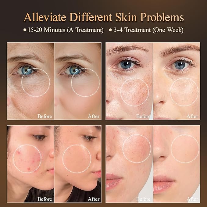 MEGELIN 7 Colors Led Light Therapy Facial Mask, Face Light Therapy Mask for Face, Reduce Wrinkles Smooth Skin, Infrared Light Skin Rejuvenation(Black)