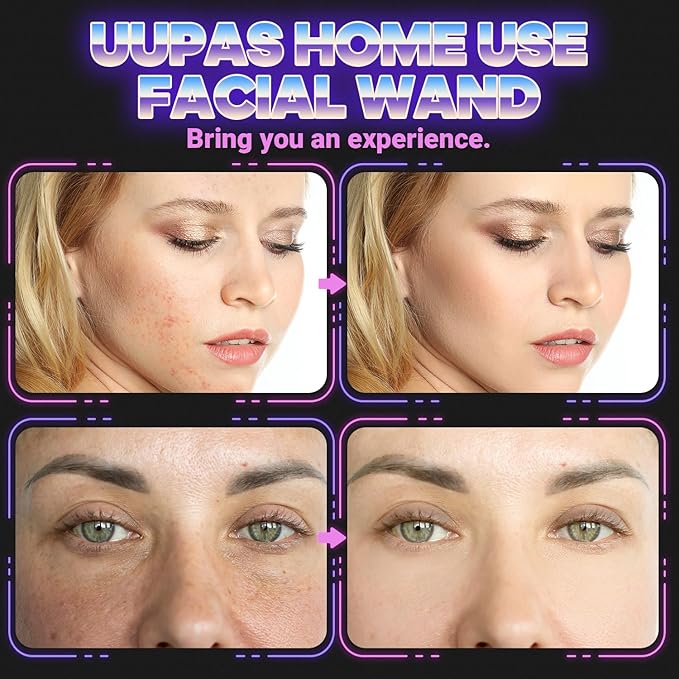 UUPAS High Frequency Skin Therapy Face Wand Facial Machine