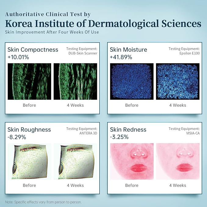 GYH 8-Color LED Face Mask Light Therapy, Red Light Therapy for Face, FSA/HSA Eligible, Wireless High Dose Green, Blue, Infrared Light Therapy Mask for Skin Care & Anti-aging, Cloud-SSS (RB-080)