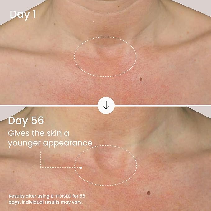 MAËLYS B-POISED Neck Firming Cream - Neck & Décolleté Firming, Tightening, and Anti-Aging Cream for Wrinkles with Brazilian Peppertree, Linoleic Acid, and Kangaroo Flower (1.7 Fl Oz)