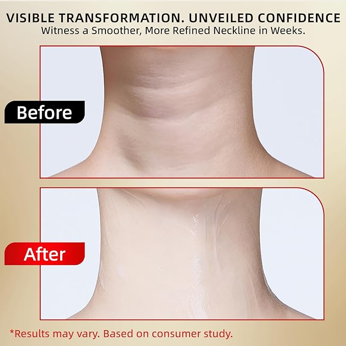 Retinol Neck Firming Cream – Neck Cream for Firming and Tightening, Skin Tightening Cream for Face, Tighten and Lift Neck Cream with Collagen & Hyaluronic Acid, Anti-Aging Moisturizer 1.76 oz