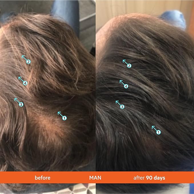 DS Labs For Men & Women Revita Conditioner - Scalp Refreshing Hydration for Fuller Looking, Weightless Hydration, Caffeine, Turmeric, Sulfate & Silicone Free, Color Safe, Refill Pouch 500 mL