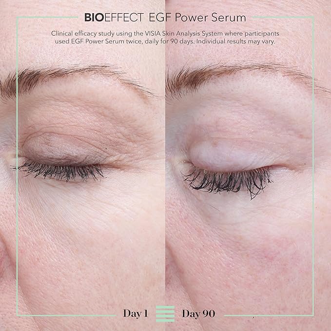 BIOEFFECT EGF Power Serum | Epidermal Growth Factor + KGF + Hyaluronic Acid | Intensive Age-Defying Face Treatment for Deep Wrinkles, Firmness & Skin Renewal, 15 mL / 0.50 oz
