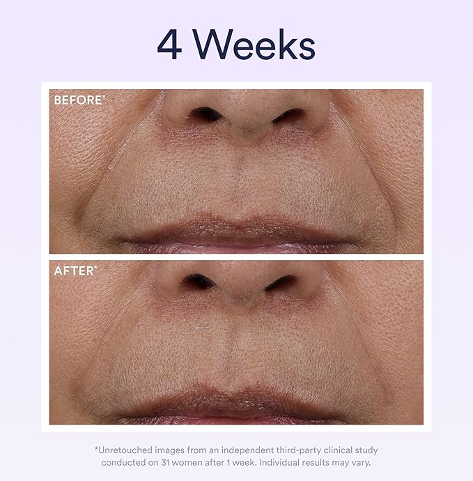 OSEA Dream Night Serum with Bio-Retinol - 1oz - Anti-Aging Night Serum for Face - Firming Peptides - Reduces Wrinkles, Firms & Brightens Skin (Pack of 2)