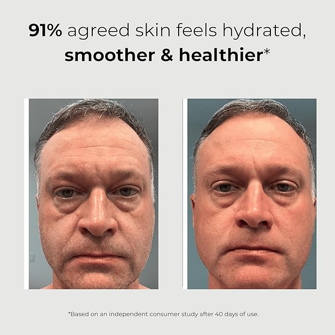 ABERA Men 6-in-1 Retinol Serum for Face, Melasma Treatment with Niacinamide & Hyaluronic Acid, Reduces Fine Lines, Wrinkles, Dark Spot Remover, Evens Tone with Aloe & Centella Asiatica, 1.06 Fl Oz