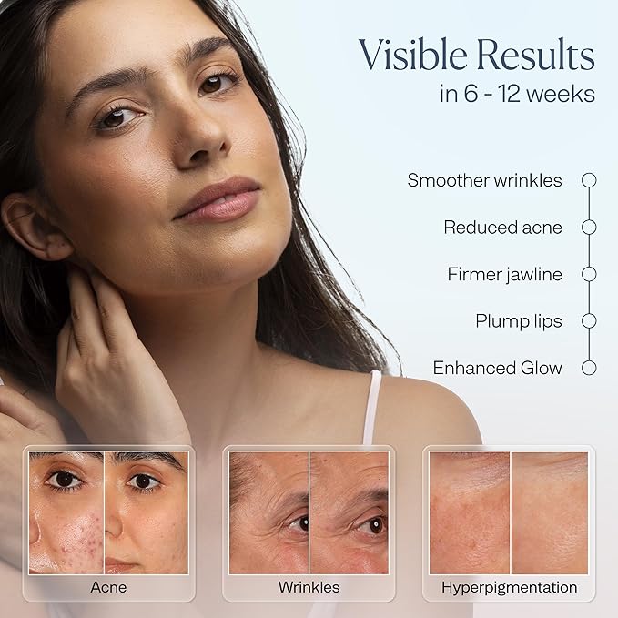 VogueNow LED Light Therapy Mask - FDA-Cleared Device for Wrinkles & Acne - Red Light Therapy for Face with Chin & Lip Coverage - Red, Blue & Near Infrared Facial Skincare Device with 280 LEDs