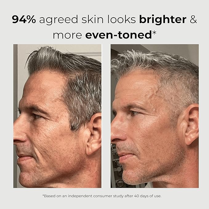 ABERA Men 6-in-1 Retinol Serum for Face, Melasma Treatment with Niacinamide & Hyaluronic Acid, Reduces Fine Lines, Wrinkles, Dark Spot Remover, Evens Tone with Aloe & Centella Asiatica, 1.06 Fl Oz