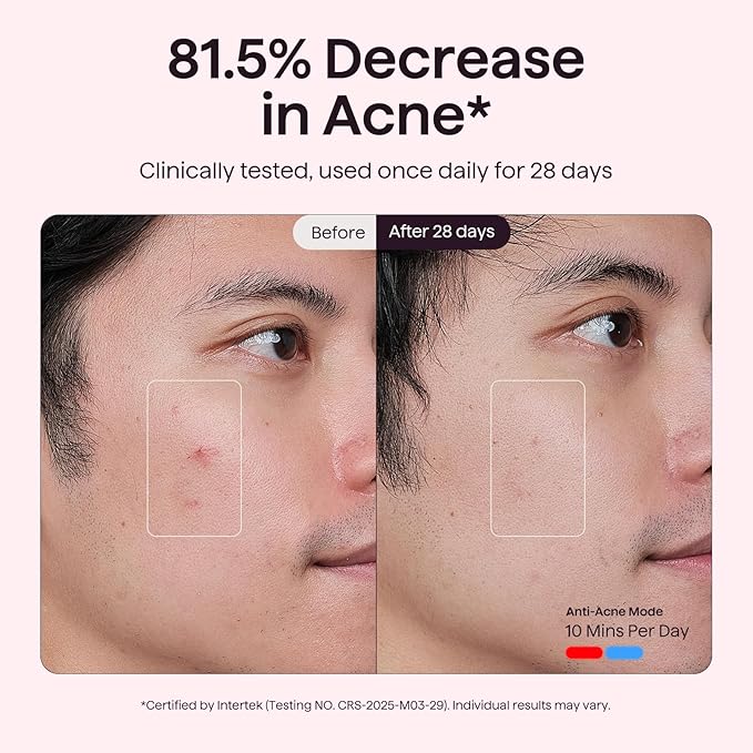 wavytalk Red Light Therapy Mask for Face, Glow Time LED Face Mask Light Therapy for Anti-Fine Line, Acne Treatment, and Skin Rejuvenation with Red, Near-Infrared Light, Blue and Amber Light Therapy