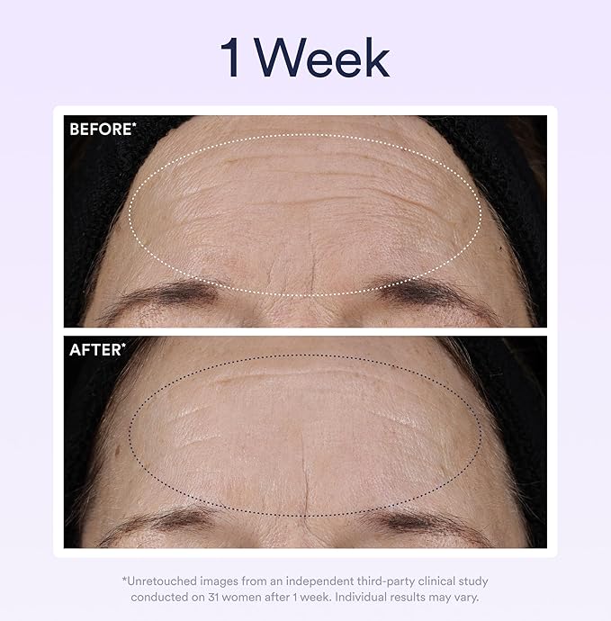 OSEA Dream Night Serum with Bio-Retinol - 1oz - Anti-Aging Night Serum for Face - Firming Peptides - Reduces Wrinkles, Firms & Brightens Skin (Pack of 2)