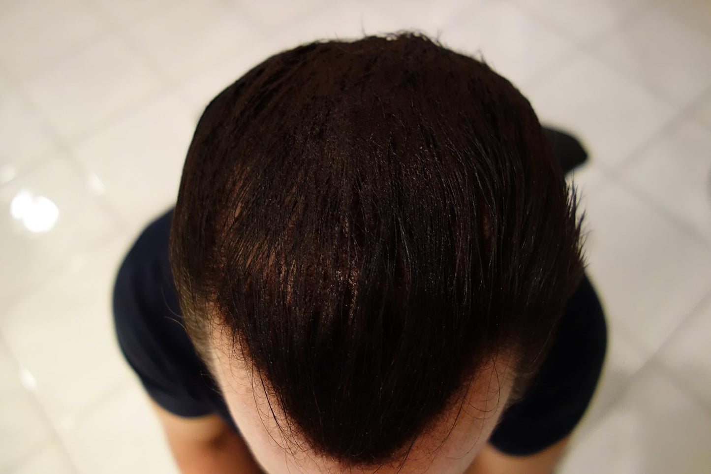 Hair Building Fibers Black 28g Bottle of Finally Hair Building Fibers and Finally Hair 120ml 4.1 oz. Bottle of Fiber Lock Hair Spray. Hair Loss Concealer Fibers (Black)