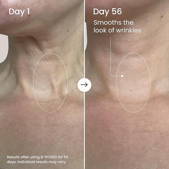 MAËLYS B-POISED Neck Firming Cream - Neck & Décolleté Firming, Tightening, and Anti-Aging Cream for Wrinkles with Brazilian Peppertree, Linoleic Acid, and Kangaroo Flower (1.7 Fl Oz)