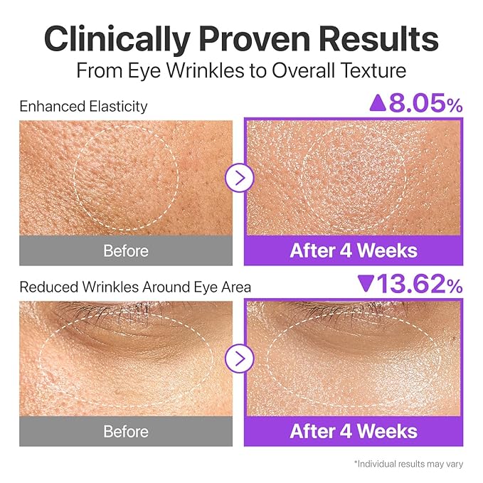 numbuzin No.9 NAD+ Lifting & Wrinkle Care Set | NAD+ BIO Lifting-sil Essence + Retinol Volumetox Eye Cream | Firming, Reduce Wrinkles, Fine Lines | Peptides | Serum for Sagging, Aging, Dull Skin